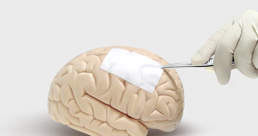 睿膜?可吸收硬腦(脊)膜補片